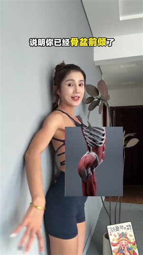 Fix Your Posture: How to Correct Anterior Pelvic Tilt