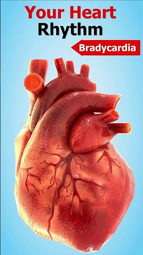 Heart Rhythms: Normal, Tachycardia, and Bradycardia #heartrate
