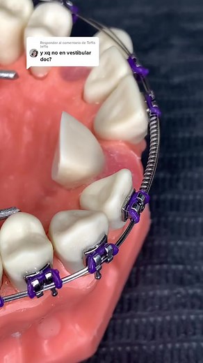 Dr. Diler Cruz #CEDC #dentist #dentistry #dentistryworld #medicine #reelsvideo #reelkarofeelkaro #reels2023 #reelitfeelit #reelschallenge #reelsfacebook #reelsviralシ #reelsusa #fypシ゚ #fypシ゚viralシ | Dr. Diler Cruz