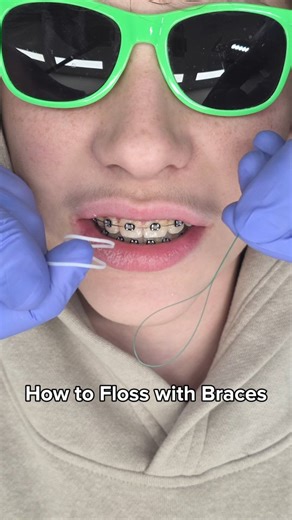 Dr. Julien | 🦷 How to Floss with Braces (Step-by-Step) Flossing with braces is tricky, but this method makes it much easier 👇 🪡 Floss threader = like a... | Instagram