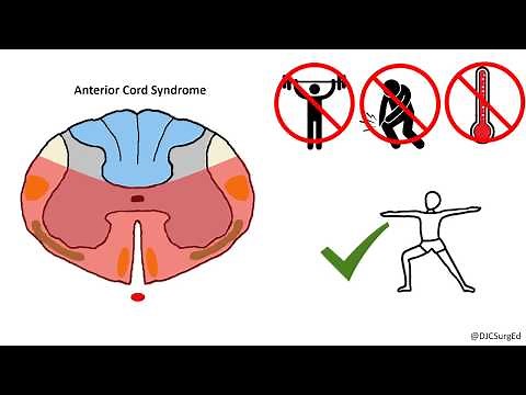 Spinal Cord Injuries