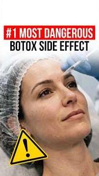 WHAT IS BOTOX? SIDE EFFECTS YOU SHOULD KNOW