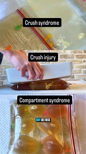 Crush injury vs crush syndrome vs compartment syndrome Learn. Adapt. Respond. | The Medical Lounge