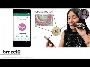BraceIO: Biosensing through Hydrogel Dental Ligatures