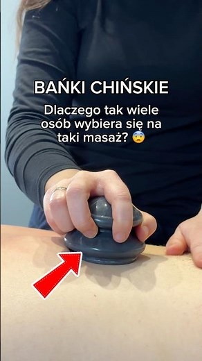 Masaż bańkami chińskimi? #bankichinskie #masaz #fizjoterapia