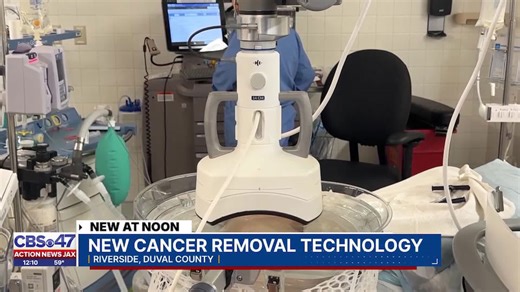 Local hospital gets new technology to perform non-invasive surgery to remove liver cancer