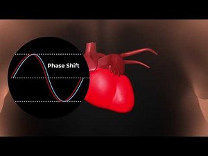 Cheetah Medical - How It Works