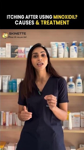 Minoxidil Causing Itching? Don’t Stop It Until You Watch This!