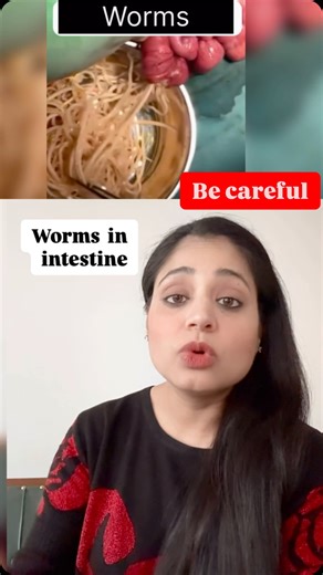 Shrutii Kaushal | Dietitian| Health Coach | "Gut Alert! Ascaris Worm Infestation Explained" #ascarisworms #intestinalparasites #guthealth #parasitology#MedicalReels... | Instagram