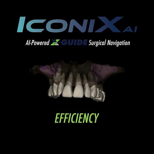 IconiX AI for X-Guide Dynamic Navigation - Experience the brilliance