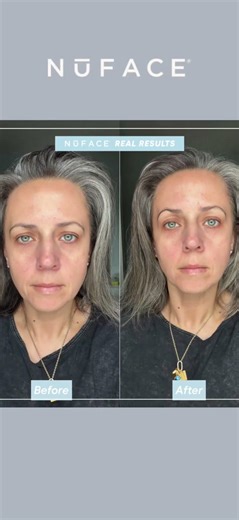 mynuface #nufacepartner NuFACE Trinity+ took my face to the gym! Also available at Ulta Beauty
