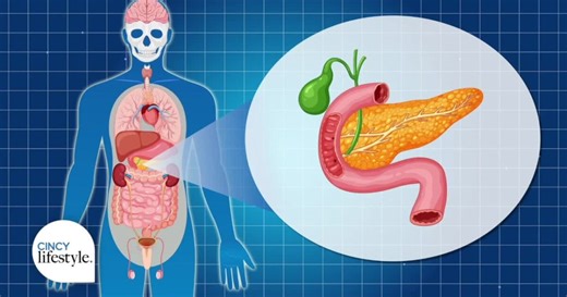 Management of Type 1 Diabetes