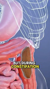 Whats Happens In Your Body During Constipation (3D Animation) #constipation #constipationrelief #constipationproblems #constipationhelp #constipationsolution #body #medical3danimation #3dmedicalanimation | Medcare777