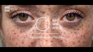 CNN Style: Freckles