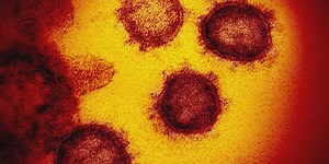 Texas A&M researchers discover COVID-19 mechanism that helps it escape immune system