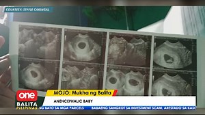 Isa sa mga kinatatakutan ng mga mommies ang magkaroon ng komplikasyon sa kanilang baby. Gaya na lang ng nangyari sa isang mommy na namatay ang bagong silang niyang sanggol dahil sa birth defect na anencephalic. Ano nga ba ang sanhi nito? | #MOJO Yeddha Pascual | One PH