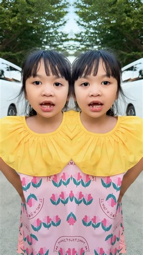 Are they really twins?