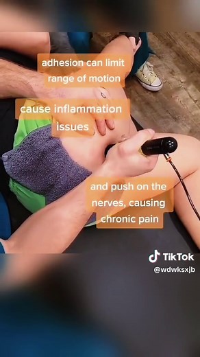 Sciatic Nerve Entrapment: Knee Pain, Hamstring Weakness & Relief