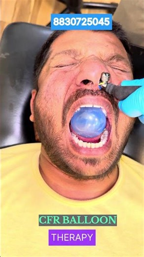 CFR for Facial Pain #chiropractor ##reelsvideo #reelsviral #migraine #virals #trending#Nashik#Pune##