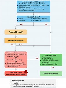 Pacing and Bradycardia Quick Summary