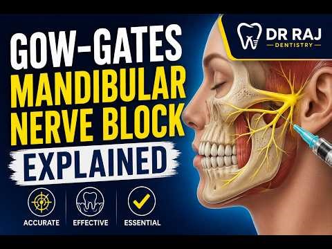 Gow-Gates Mandibular Nerve Block Explained ||Dr Raj Dentistry||