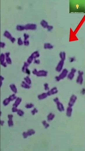 Así se ven los cromosomas observados desde el microscopio #biology #biologia #ciencia #datos