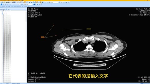 micro dicom 功能介绍
