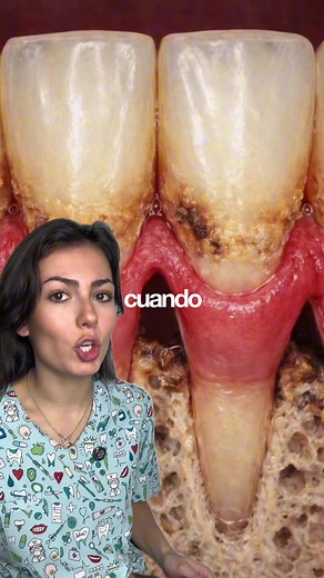 Evita la enfermedad periodontal cepillándote bien los dientes