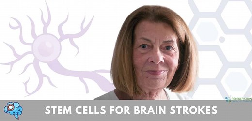 Neurogenic Stem Cell Treatment For Stroke Recovery