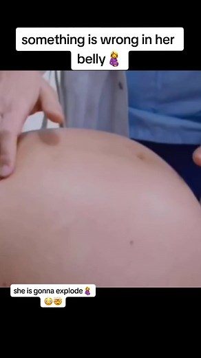 probably twins🤰😳🤯 #fypシ゚viral #fyp #feed #huge #bellyfat #bellyfyp #giantbellys #biggest #biggestbellys #floated #bump #date #labor #delivery #sittinginprego #pregolove