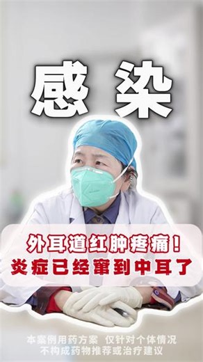 外耳道红肿疼痛，炎症已经窜到中耳了。 #郑雅丽 #耳朵疼 #外耳道 #医学科普 #热点