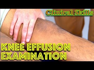 Knee Effusion - How to Perform the Patella Tap and Sweep Tests - Clinical Skills - Dr Gill