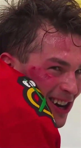 Faceplant with flexible hips