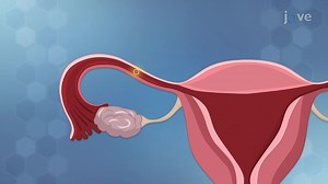 Video: Genetic Variation