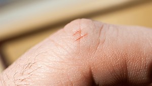 This Is Why Papercuts Hurt So Goddamn Much