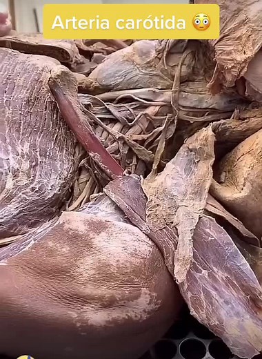 #Micro_bios 2.0 on TikTok