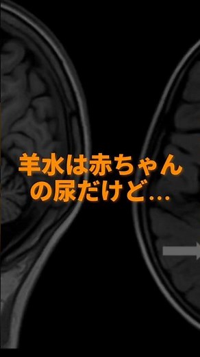 羊水はiPS細胞？【羊水由来間葉系幹細胞 】#雑学 #医学