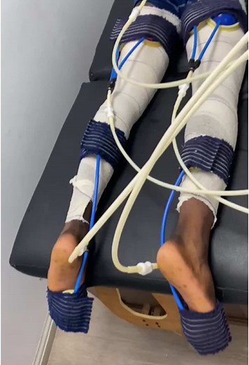 Post Revovery Treatment gets you back on track faster. #postrecovery #ryp