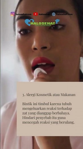 5 Penyebab Bintik Putih di Bibir dan Cara Mengatasinya #penyebab #bibirbintikputih #penyakit #kulit