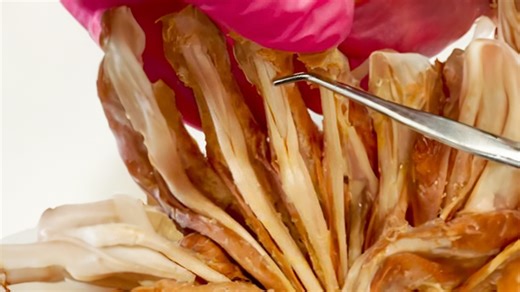 Understanding the flexor digitorum muscles