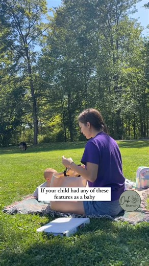 Julia | Toxin-Free Products and Home on Instagram: "What it means👇🏼 These features are: Tongue/lip tie Stork bite Sacral dimple Sugar bug vein These are all subtle physical clues (along with other midline defects) that can point to a possible MTHFR gene mutation. This genetic variant impacts how the body methylates, or detoxes from toxins. 👉🏼Just comment “CLEAN” and I’ll send you 60+ clean products to swap in your home! The MTHFR gene is responsible for converting folic acid into its usable 