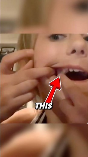 Parrot Pulls Girl's Loose Tooth! 😱