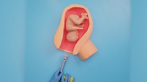 Technique d'extraction par ventouse en obstétrique 🩺👶 | Brico Sympa