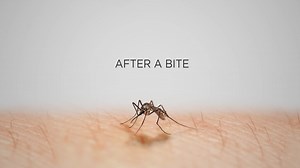 15 reactions · 21 comments | Suck out irritating insect saliva/venom with Bug Bite Thing for instant, chemical-free relief from bug bites + stings   Award-Winning ✅ Clinically Proven 戮 Kid-Friendly ♻️ Reusable ⭐️ Over 25,000 5-Star Reviews See how it works ⬇️⬇️⬇️ bugbitething.com/pages/how-it-works  Can't wait for shipping? Find us in stores! bugbitething.com/pages/store-locator | Bug Bite Thing | Facebook