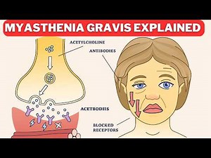 Myasthenia Gravis Explained | Symptoms, Diagnosis, and Treatment