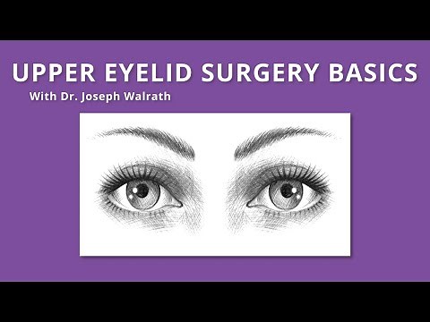 Upper Eyelid Surgery Basics