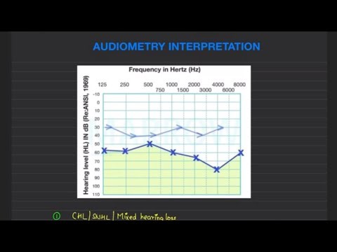 AUDIOGRAM INTERPRETATION