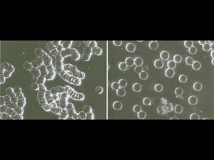 Structured Water [How It Works 2020] Effects on Blood Cells and Hydration