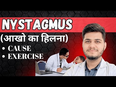 Nystagmus क्या होता है? Causes, Treatment & Powerful Eye Exercises