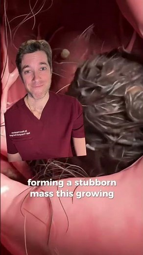 The Medical Risks of Eating Hair